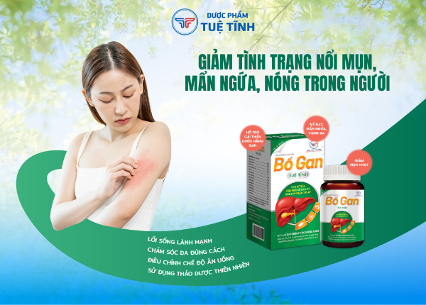 DƯỢC PHẨM TUỆ TĨNH RA MẮT BỔ GAN TUỆ TĨNH: BẢO VỆ GAN TỪ TINH HOA THẢO DƯỢC
