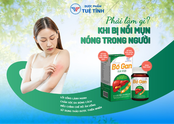 FTT_nong_trong_nguoi_noi_mun_phai_lam_sao