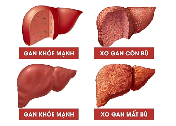 FTT_Xo_gan_la_ben_gi_co_nguy_hiem_khong