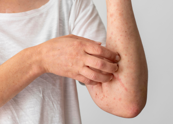 Bệnh viêm gan: Nguyên nhân và những lầm tưởng dễ mắc phải