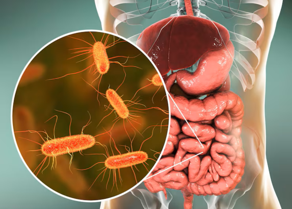 FTT-loan-khuan-duong-ruot-la-gi-tai-sao-chung-ta-hay-mac-phai