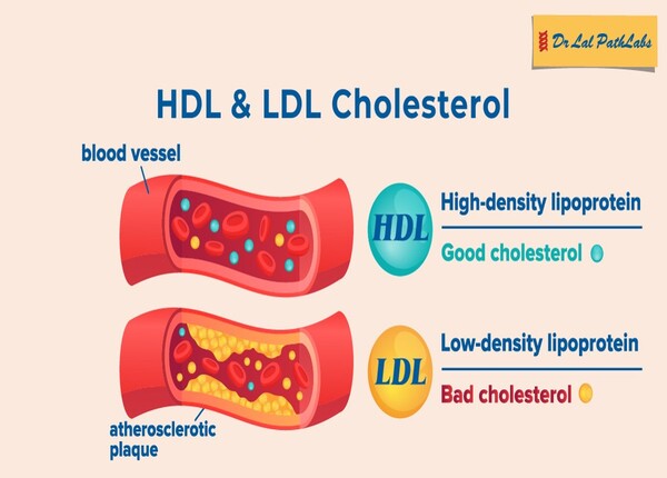 FTT-Cholesterol-la-gi-cach-kiem-soat-cholesterol-trong-mau-1