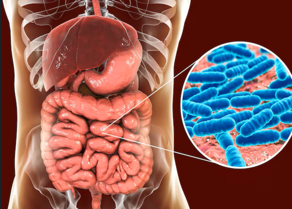 FTT-Phinh-dai-trang-do-nhiem-doc-la-gi-nguyen-nhan-dau-hieu-nhan-biet-1