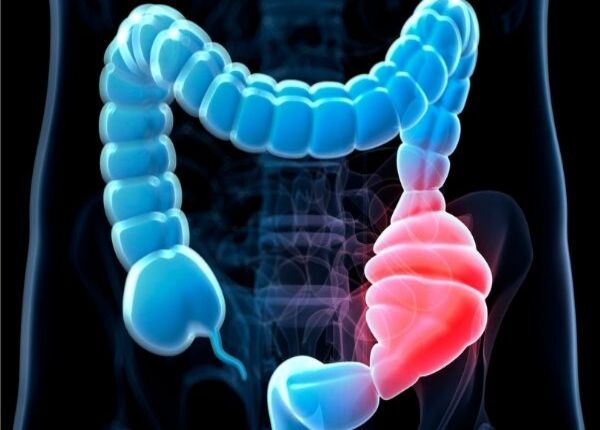 Phình đại tràng do nhiễm độc là gì? Nguyên nhân, dấu hiệu nhận biết? 