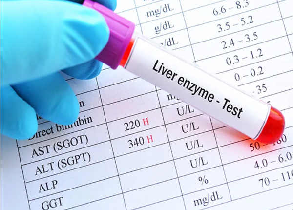 Chỉ số men gan cao bao nhiêu là nguy hiểm?