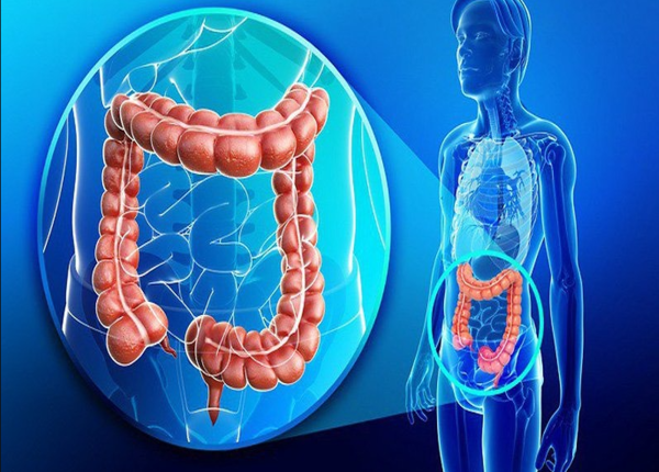 Ung thư đại tràng có lây nhiễm không