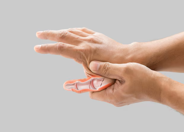 Người bị thoái hóa khớp ngón cái thường xuyên cảm thấy đau mạnh ngón cái