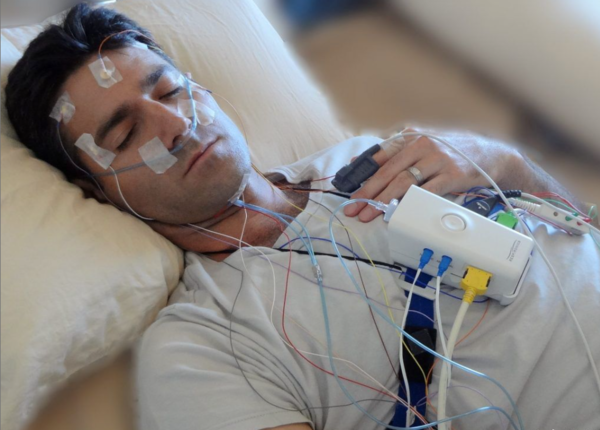 Các bước xác định ngủ rũ qua nhiều bước