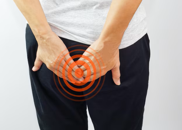 Xuất huyết dạ dày không chỉ do dạ dày viêm mà còn có thể do trĩ, polyp