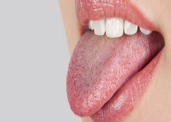 Hội chứng Sjogren: Nguyên nhân và biến chứng gặp phải